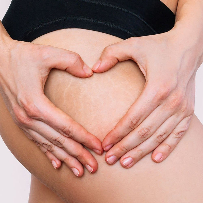 Anti Stretch Mark and Body Care